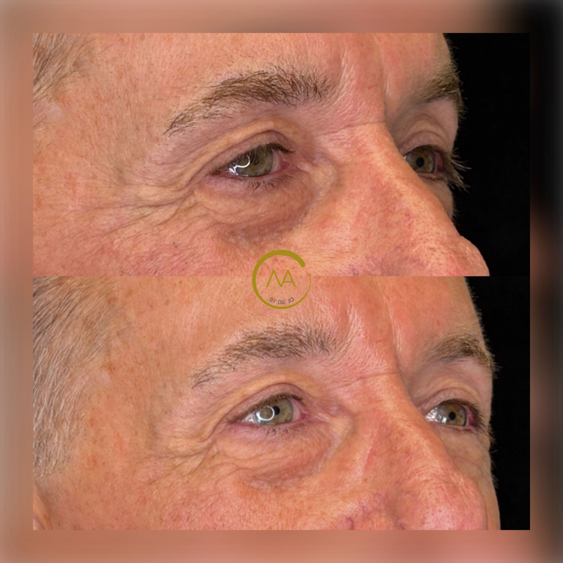 gallery-sylfirm-x-17-1