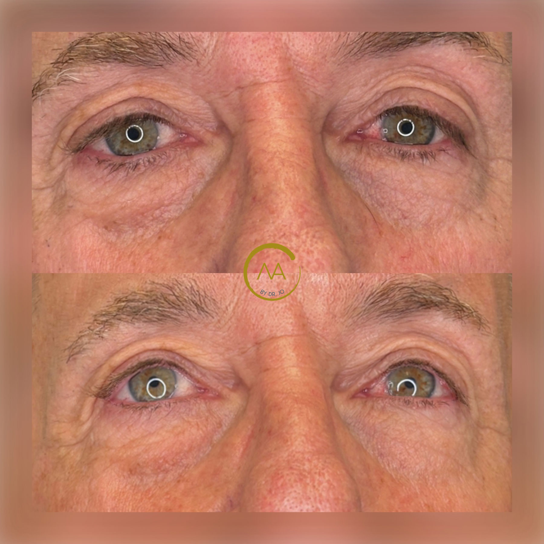 gallery-sylfirm-x-17-2