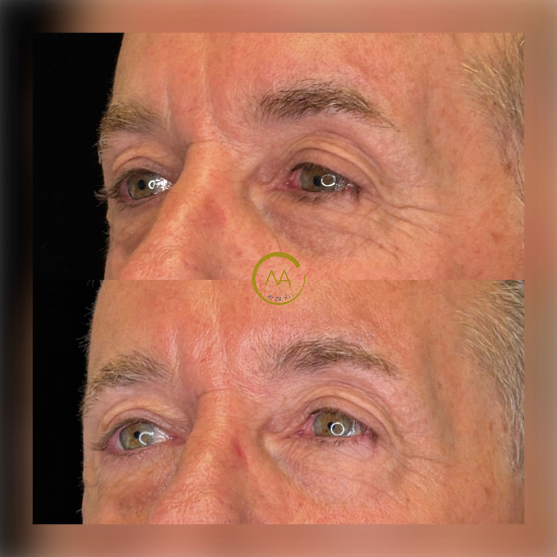 gallery-sylfirm-x-17-3