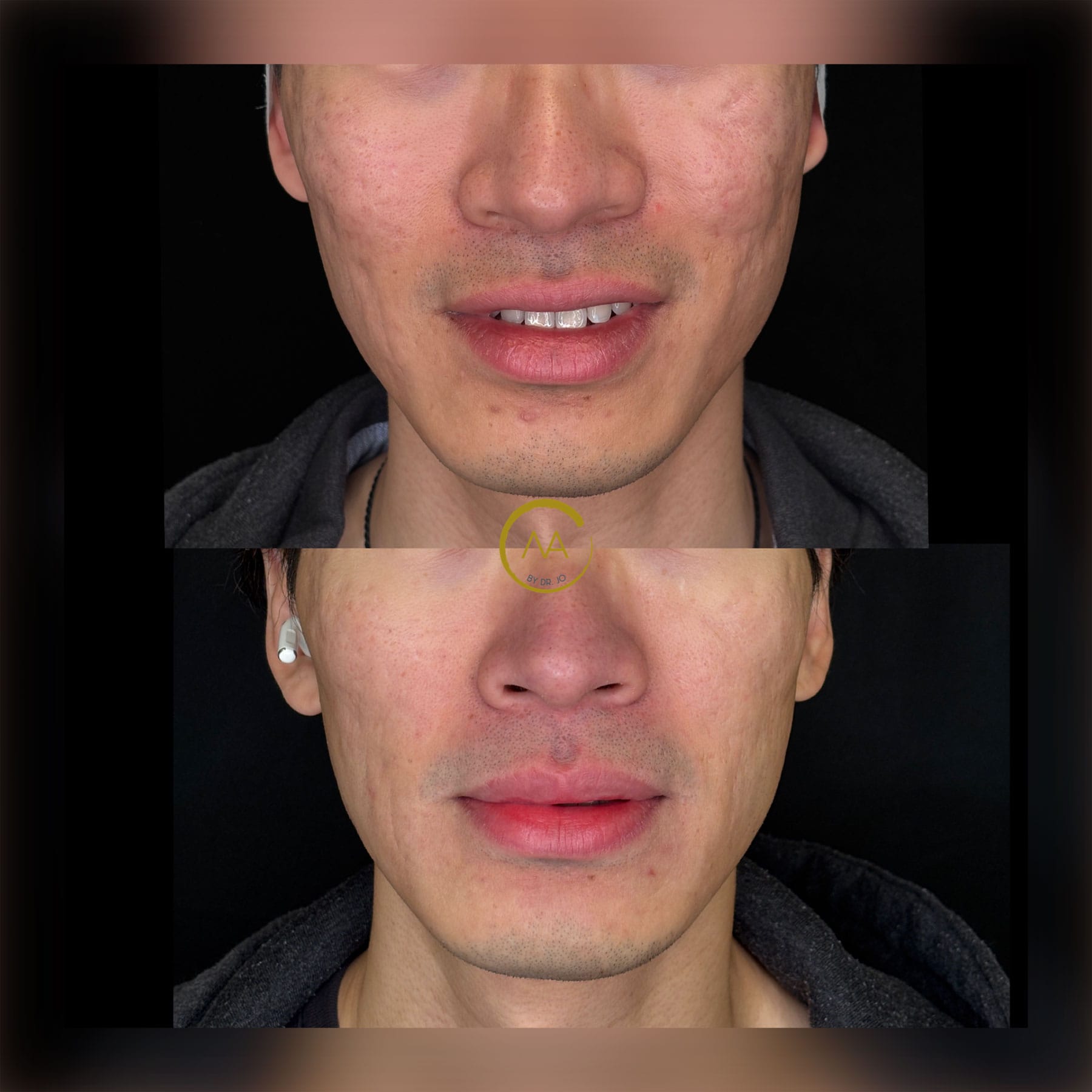 gallery-sylfirm-x-18-3