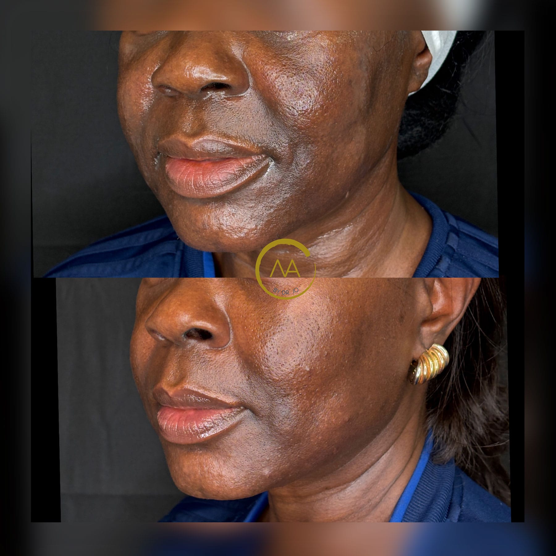 gallery-sylfirm-x-20a