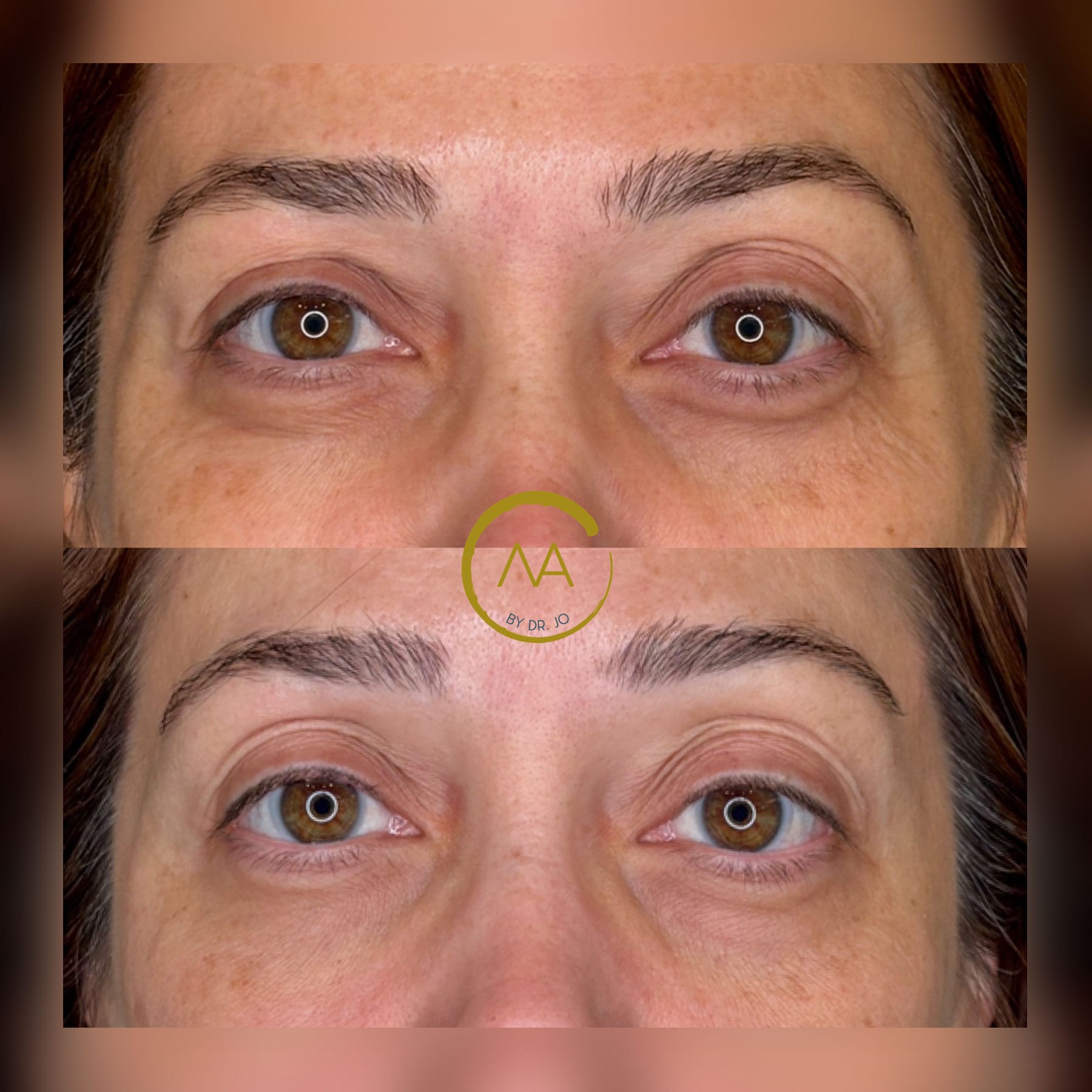 gallery-sylfirm-x-20a