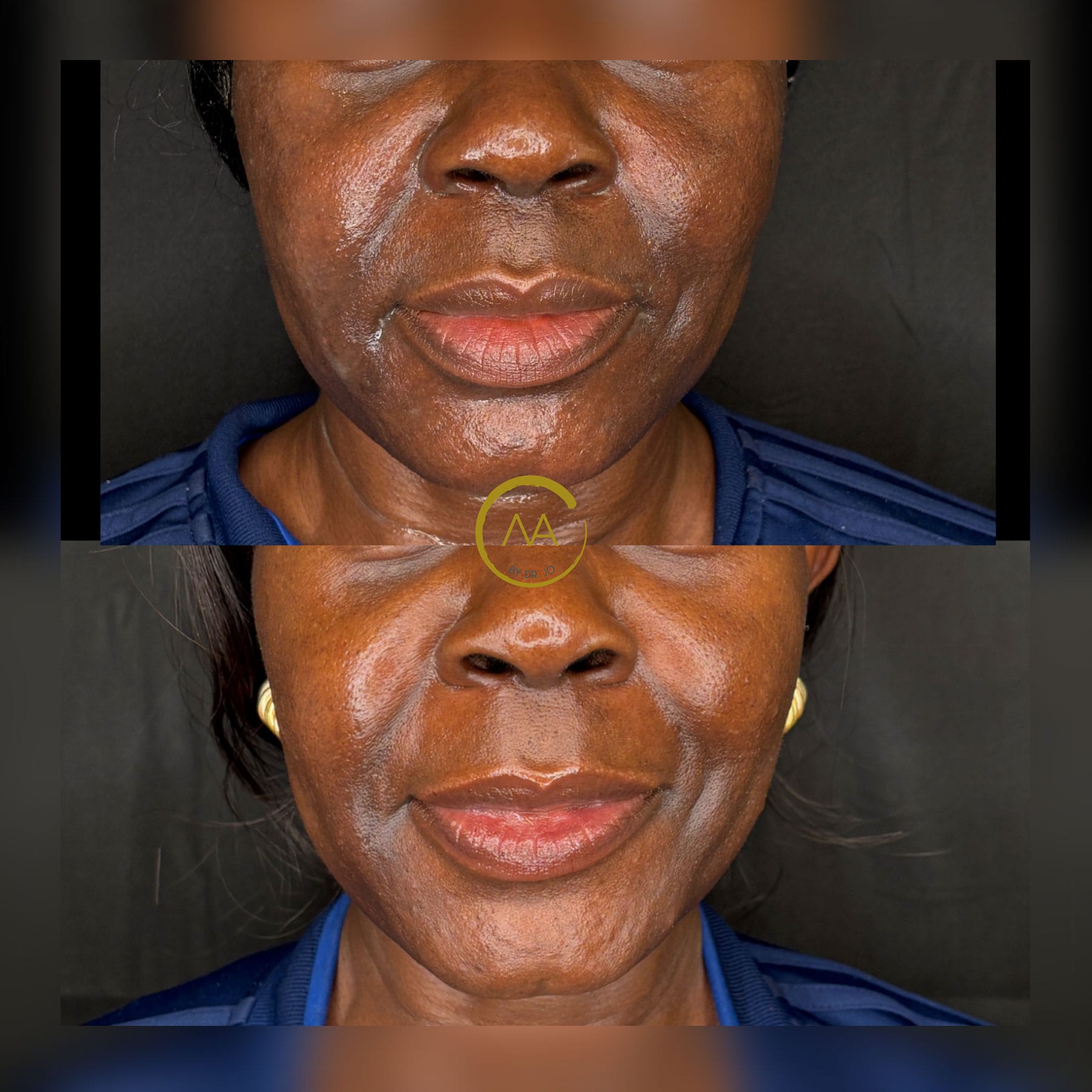 gallery-sylfirm-x-20b