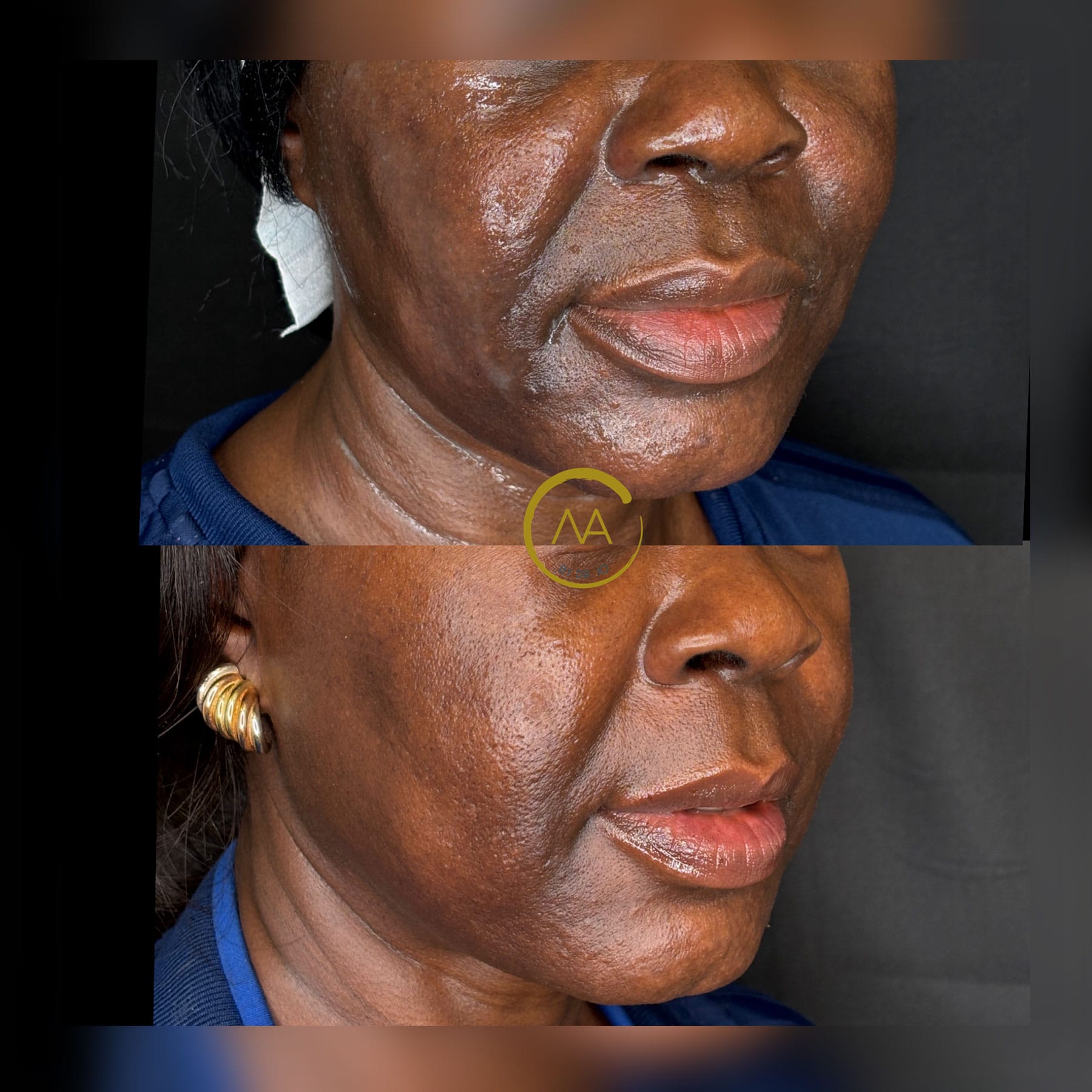 gallery-sylfirm-x-20c