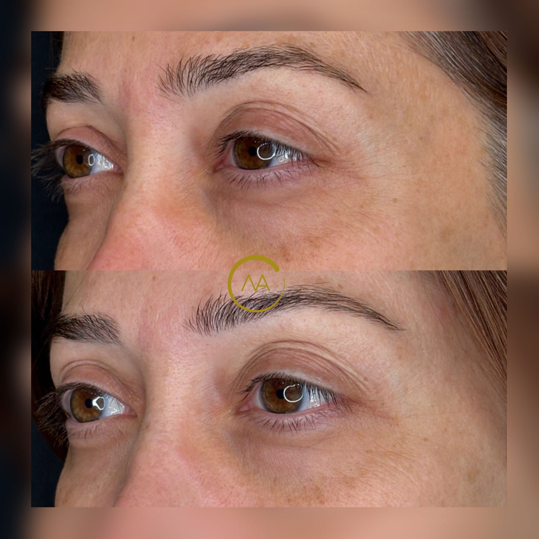 gallery-sylfirm-x-20c