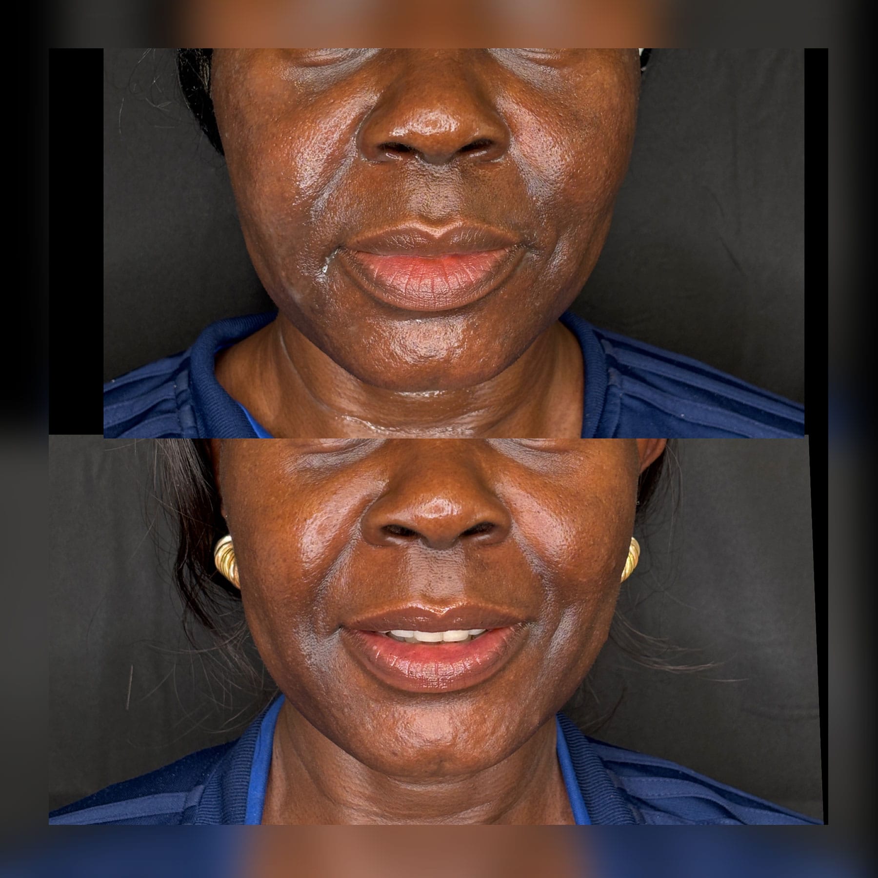 gallery-sylfirm-x-20d