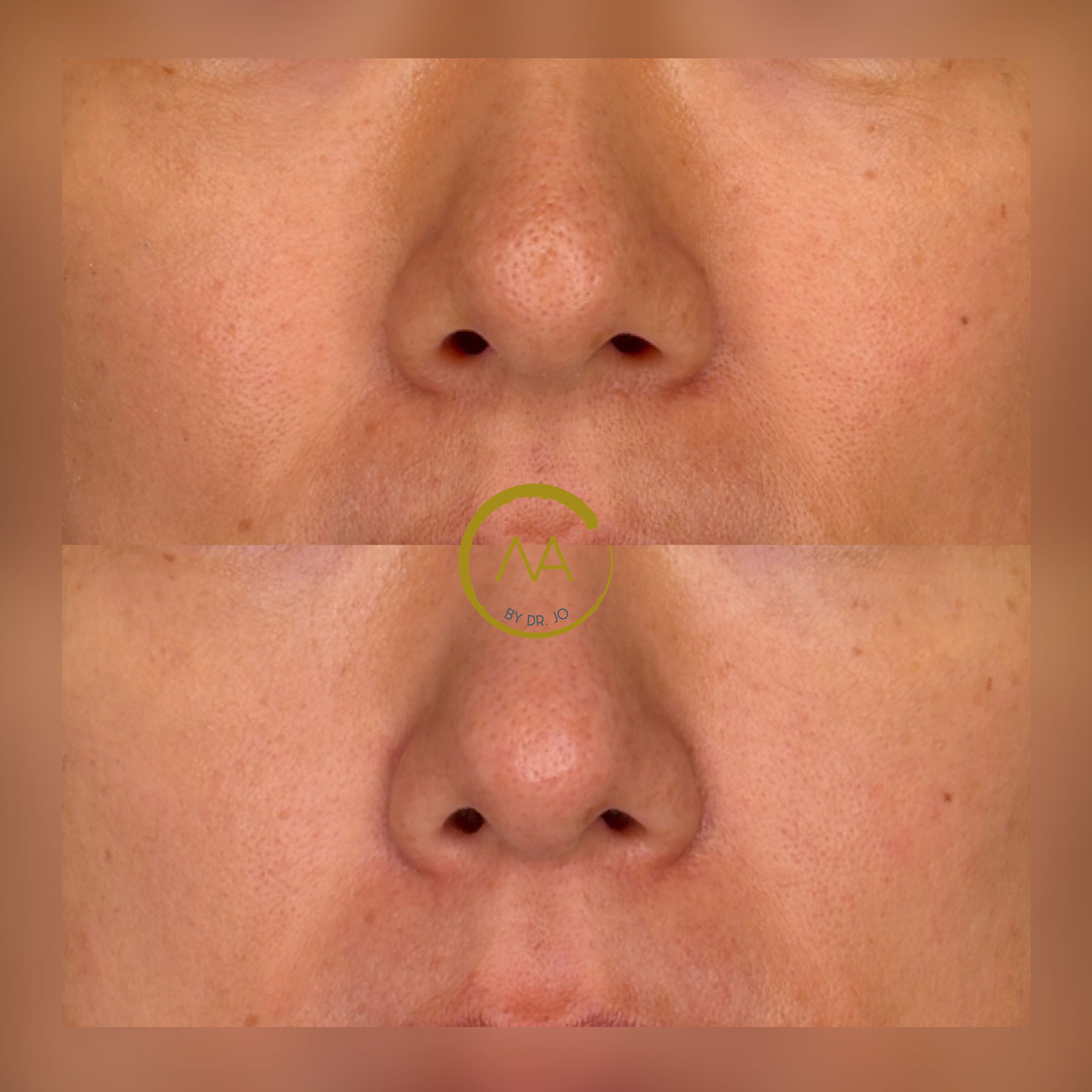 gallery-sylfirm-x-21a