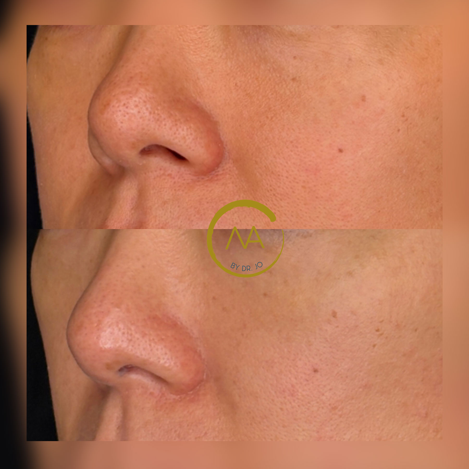 gallery-sylfirm-x-21b