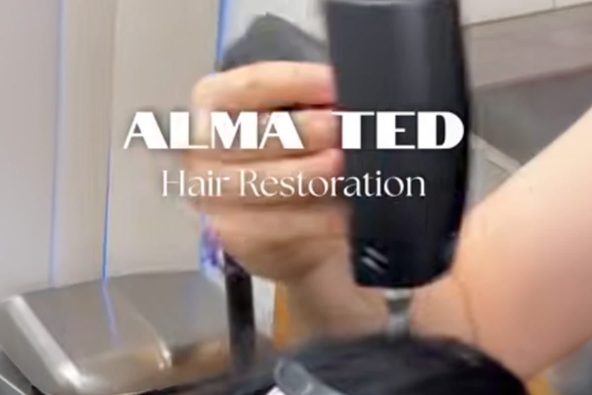 video preview