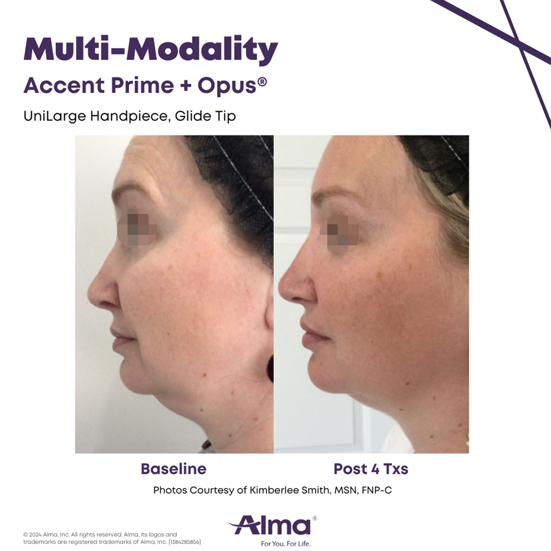 oma-gallery-accent-prime-1
