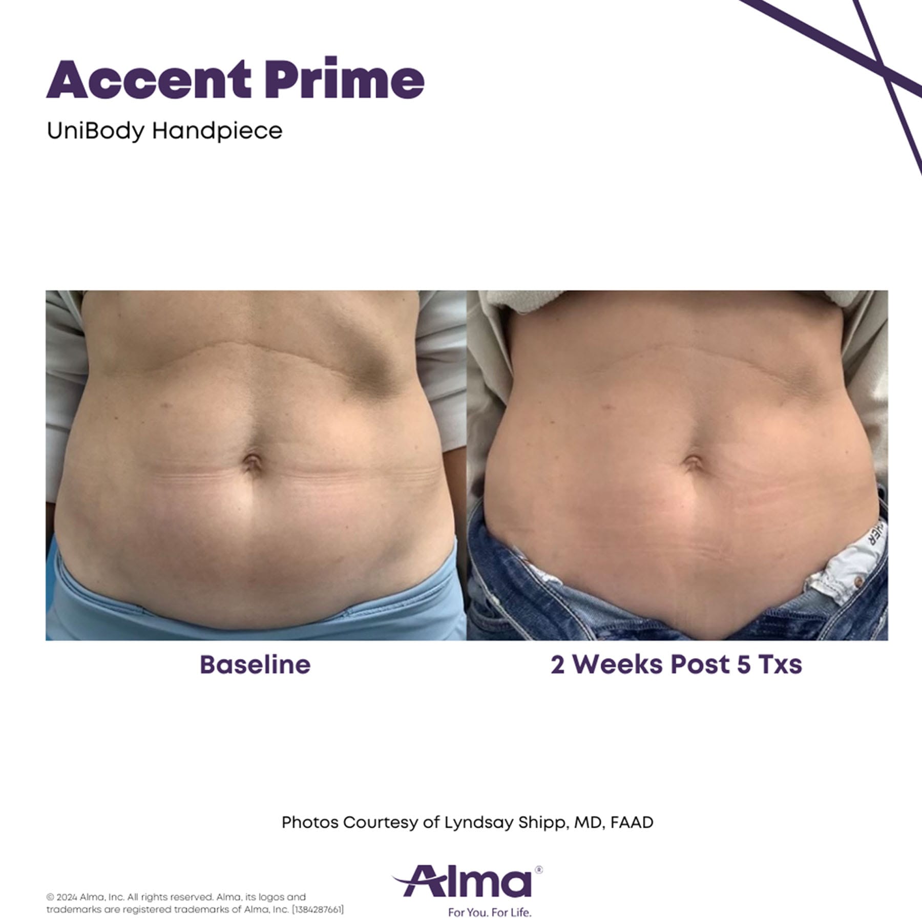 oma-gallery-accent-prime-2