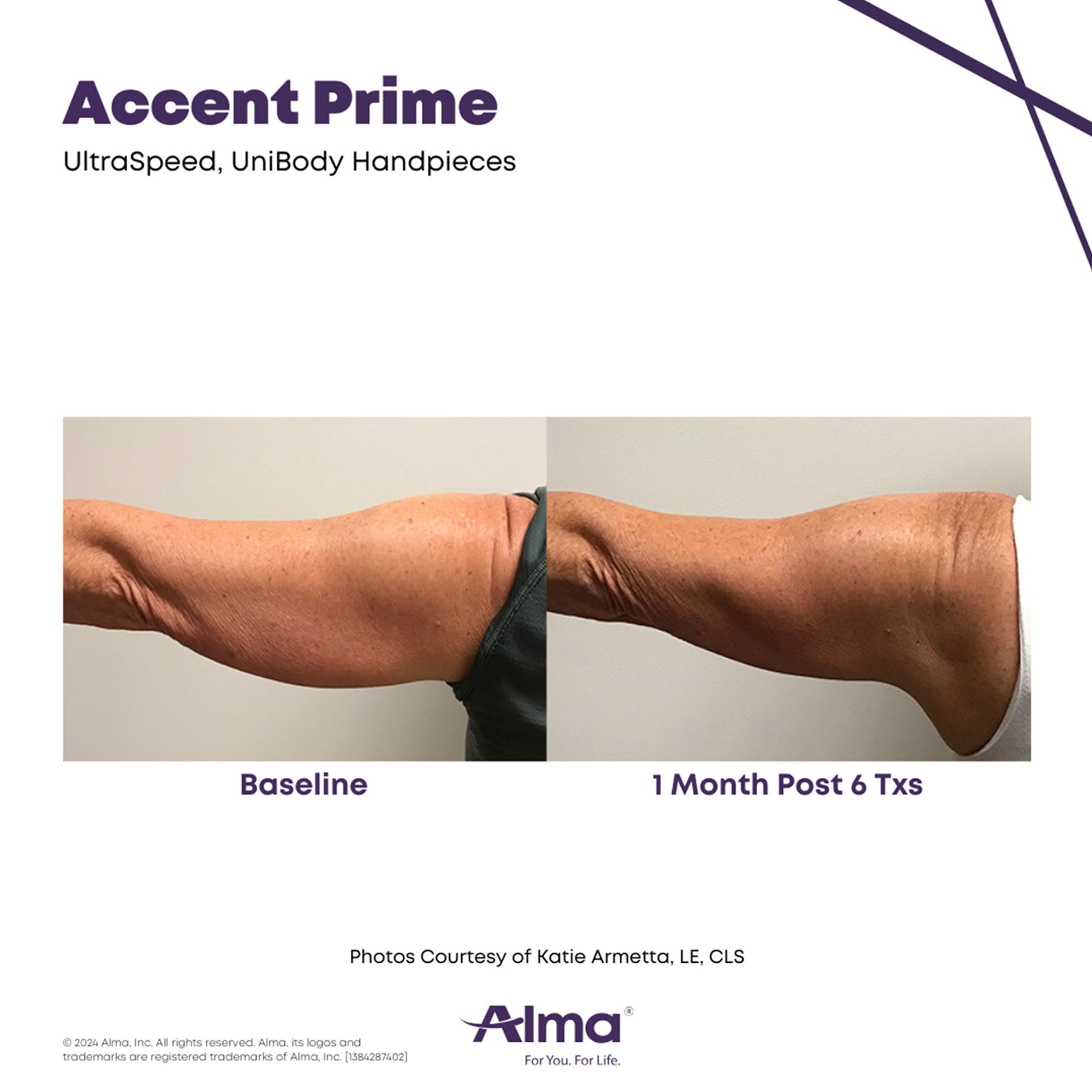 oma-gallery-accent-prime-3