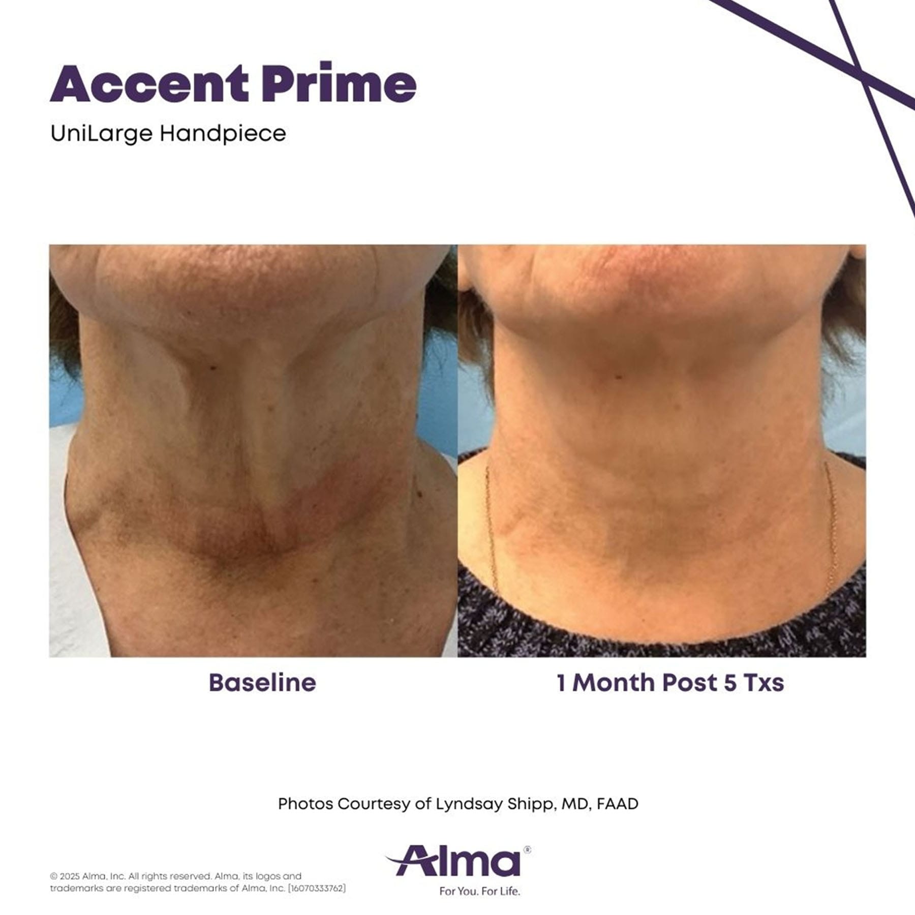 oma-gallery-accent-prime-4