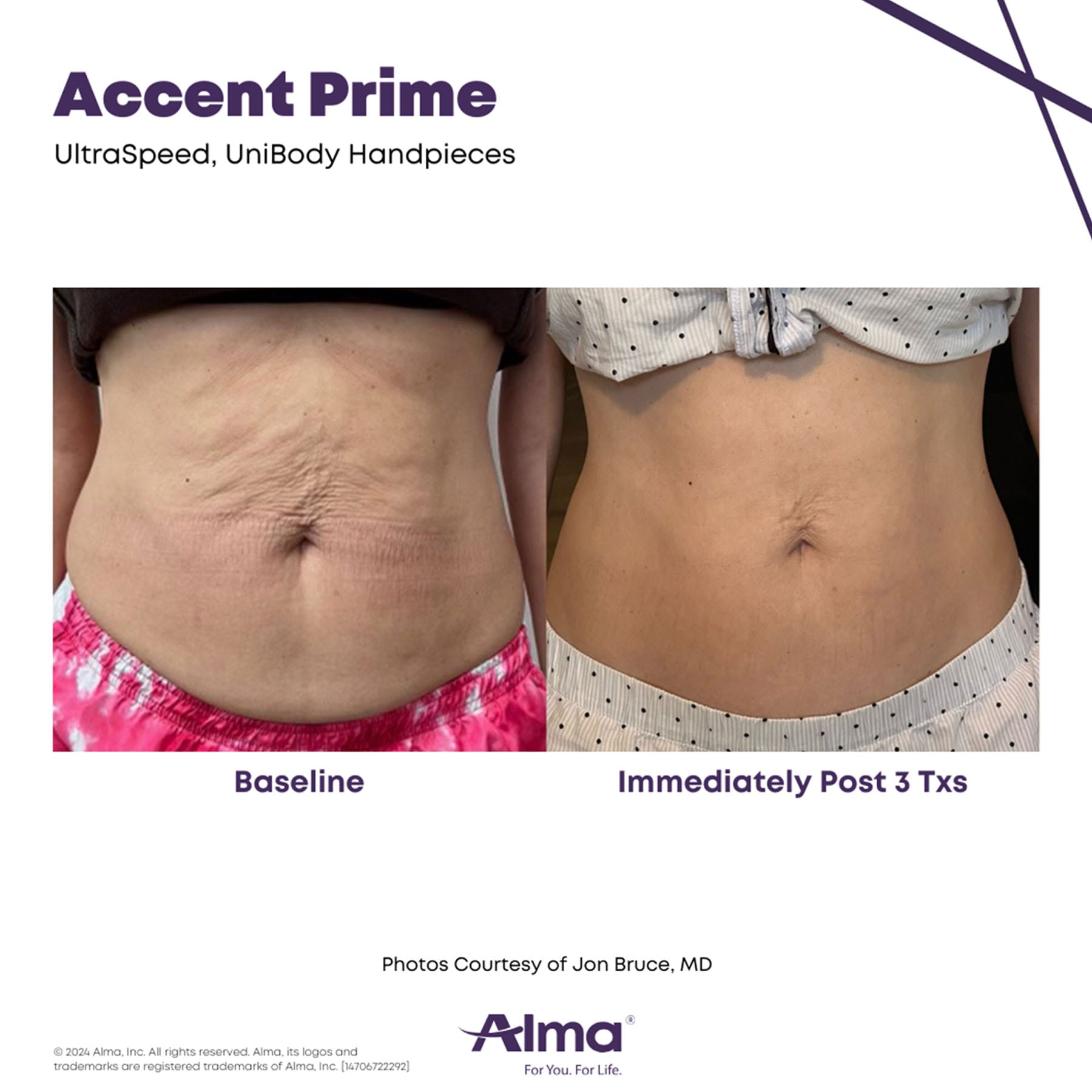 oma-gallery-accent-prime-5