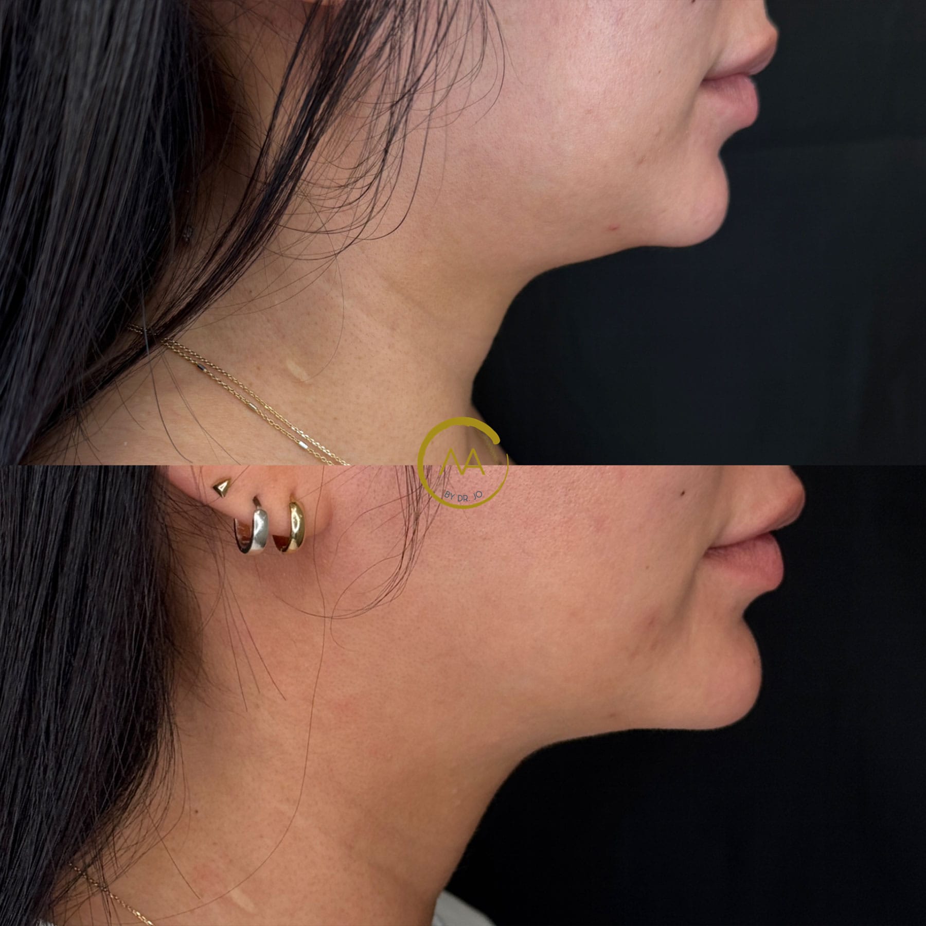 accent-prime-4a
